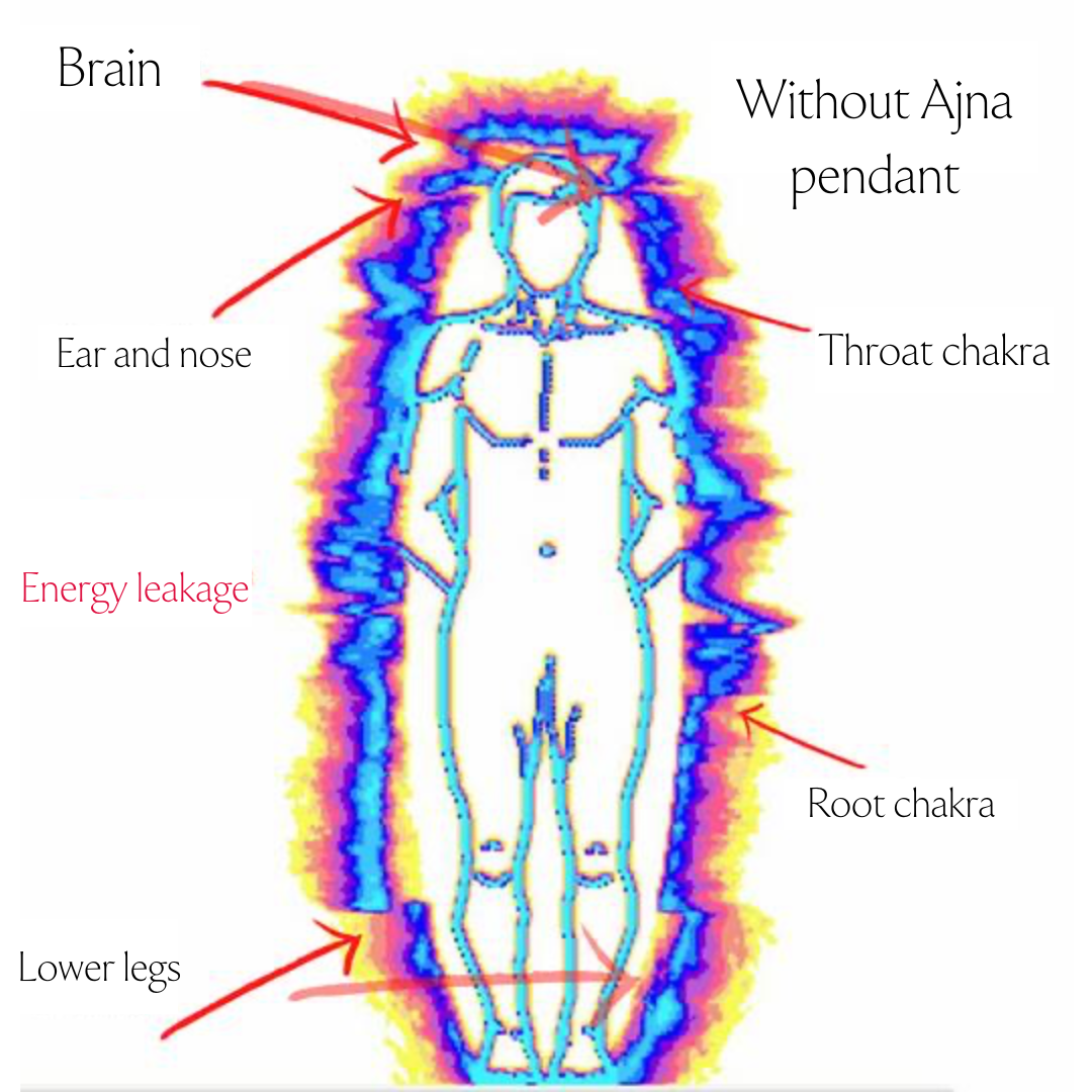 Image alt text